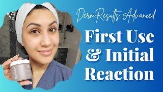 Arbonne DermResults Advanced  First Use and Reaction [upl. by Kurtzman]