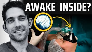 Exposed Surprising Brain Activity During Surgery [upl. by Duane407]