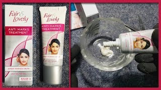 Fair and Lovely Anti Marks Treatment Review  Acne Spots Dark Circles Removal Beauty Cream Product [upl. by Schwerin]