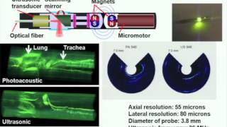 Photoacoustic tomography ultrasonically breaking through the optical diffusion limit [upl. by Anaihk13]