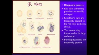 Laboratory diagnosis of malaria parasite [upl. by Monteria]