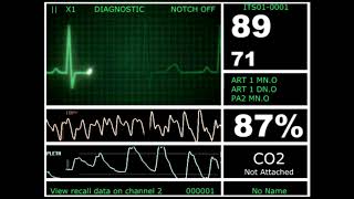 Hospital Monitor with FlatLine L HD [upl. by Adeys67]