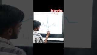 Electrocardiogram ECG  Biology viral shorts biology ecg [upl. by Audette]