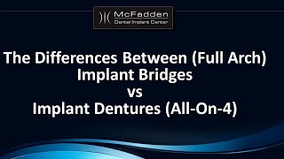 Implant Bridges vs Implant Dentures AllOn4 [upl. by Nnylarak]