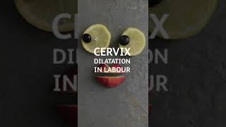 Cervical dilation [upl. by Hephzipa303]