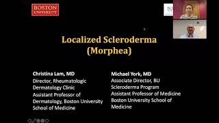 Localized Scleroderma Morphea Christina Lam MD Michael York MD [upl. by Lallage]