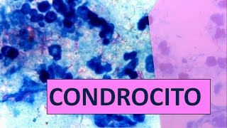 CONDROCITOCONDROBLASTOCONDROPLASTO HISTOLOGIA 3 [upl. by Chanda939]