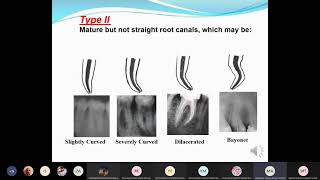 Endo lec1 [upl. by Langille]