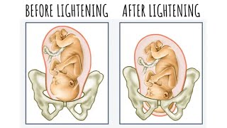 When Labor Will Start if Youre 1 Centimeter Dilated  How to Check a Cervix for Dilation [upl. by Sessler]