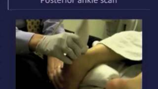 Musculoskeletal Ultrasound Evaluation of Ankle Tendons and Ligaments [upl. by Eeima]