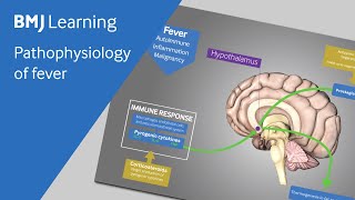 Pathophysiology of fever explained [upl. by Ruelle]