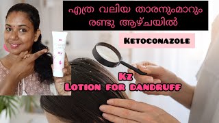 ✅️ketoconazole lotion 2for dandruff kz lotion review 2023Anti fungalantidandruff [upl. by Vorfeld]