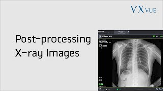 VXvue Quick Guide 03 Postprocessing Xray Images [upl. by Notgnilra843]