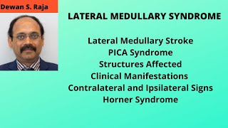 Wallenberg Syndrome Lateral Medullary Syndrome [upl. by Vikki]