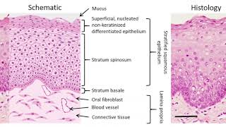 Premalignancies and Squamous Cell Carcinoma [upl. by Eelyam11]