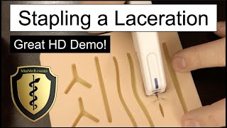 Closing a Laceration Using a Skin Stapler  Stepbystep instructions [upl. by Hoon]