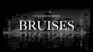 Lewis Capaldi  Bruises  CHILLHOUSE REMIX  VISUALIZER Lyrik Video [upl. by Esinereb783]