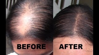 4 MAKEUP HOW TO GET A SCALP LINE OR NATURAL PART FOR THIN HAIR [upl. by Stan501]