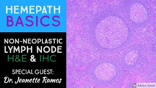 Hemepath Basics NonNeoplastic Lymph Node Histology amp Immunostains with Dr Jeanette Ramos [upl. by Icyak709]