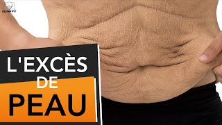 Excès de peau après une perte de poids causes et solutions peau flasque détendue [upl. by Ettenwahs]