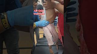 CP Child treatment drrajneeshkant chiropractor worldfamouschiropractor [upl. by Smitt]