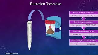 Concentration techniques in Stool  Floatation techniques  Sedimentation techniques  parasites [upl. by Ranique]