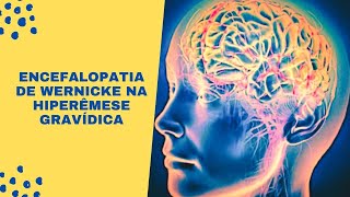 Encefalopatia de Wernicke na Hiperêmese Gravídica Revisão Sistemática [upl. by Hguh]