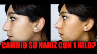 Hilos tensores nariz 🔥  Rinomodelación con hilos  Todo sobre la RINOPLASTIA CON HILOS 😱 [upl. by Kreg]