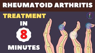 Rheumatoid Arthritis Treatment  New Medicines and Updates [upl. by Marianne569]