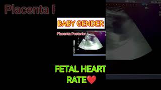 FETAL HEART RATE VS BABY GENDER shortsfeed shorts [upl. by Arannahs371]