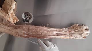 Muscles of extensor compartment of Forearm  Muscles of posterior compartment of forearm [upl. by Casimire305]