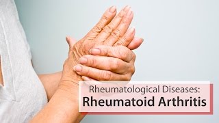 How to Manage Rheumatoid Arthritis [upl. by Ester]