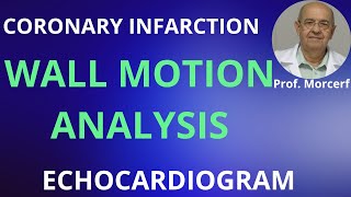 Three rules to analyze LV segmental contraction [upl. by Herzel]