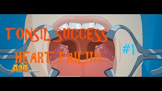 DOCTORMATERIAN TONSIL AND HEART SUGERY FAIL  Operate Now Part 1 [upl. by Airahcaz]