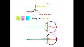 Loeil Cest quoi le phénomène daccommodation Quels sont les défauts comment les corriger [upl. by Wailoo232]