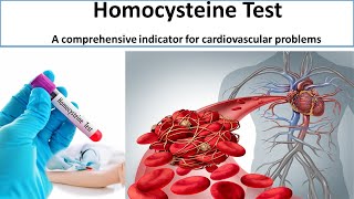 Homocysteine Test A comprehensive indicator for cardiovascular problems [upl. by Ludvig966]