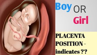 Placenta Position really predict the Baby gender  II Posterior and Anterior Placenta positions [upl. by Justinn736]