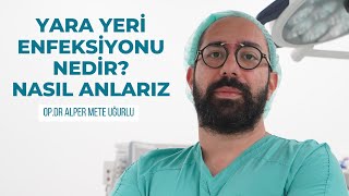 Yara Yeri Enfeksiyonu Nedir NASIL ANLARIZ [upl. by Eceinehs]