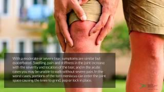 Meniscus Tears – Causes Symptoms and Treatment [upl. by Vivl]