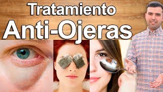 ADIÓS OJERAS Y BOLSAS EN LOS OJOS EN MINUTOS Y PARA SIEMPRE  Remedios Caseros Para Eliminarlas [upl. by Ggerg]