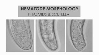 NEMATODE MORPHOLOGY PHASMIDS AND SCUTELLA [upl. by Johnsson426]