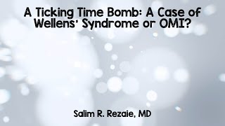 A Ticking Time Bomb A Case of Wellens Syndrome or OMI [upl. by Anrol]