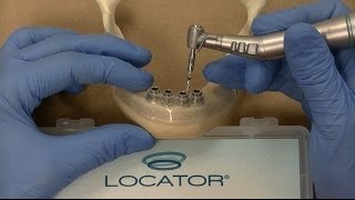 Zest LODI Mandibular Guided Surgery Demonstration  Technique [upl. by Aihsekal]