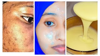 wajiga madmadowga iyo haaraha 7dayz isaga saar wajigagana ku cadee dark spot on face removal [upl. by Anelav613]