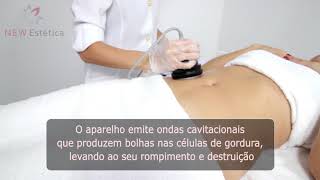 Como usar Mini Cavitação 40KHz  Estética HomeUse [upl. by Mord667]