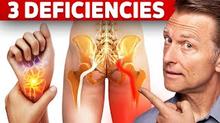 The 3 Vitamin Deficiencies in Sciatica and Carpal Tunnel Syndrome [upl. by Aynot938]