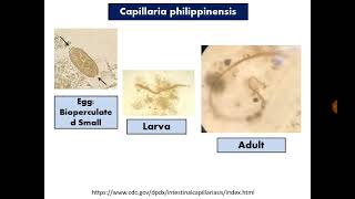 Para Findings 4 Capillaria philippinensis in Stool [upl. by Enorej]