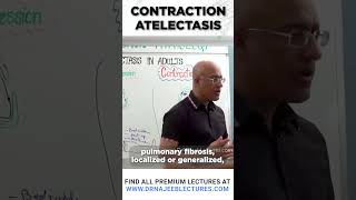 Contraction Atelectasis drnajeeb drnajeeblectures shortvideostatus [upl. by Etnaik]