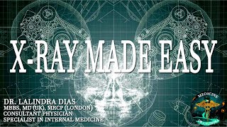 XRay Made Easy  DrLalindra Dias [upl. by Eyaj]