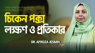 চিকেন পক্স কেনো হয়ে থাকে সঠিকটা জানুন  Dr Afroza Jesmin  LifeSpring [upl. by Anitroc958]